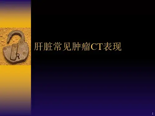 肝脏常见肿瘤CT表现-PPT课件