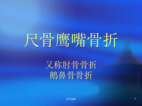 尺骨鹰嘴骨折