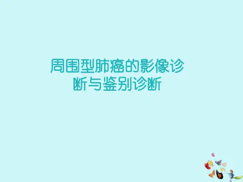 周围型肺癌的影像诊断与鉴别诊断