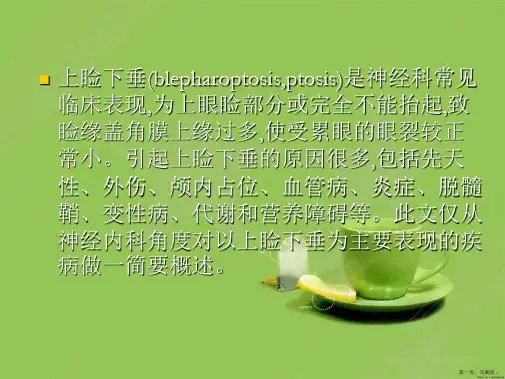 上睑下垂的病因诊断和鉴别诊断
