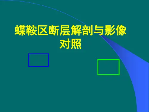 蝶鞍区断层解剖与影像对照