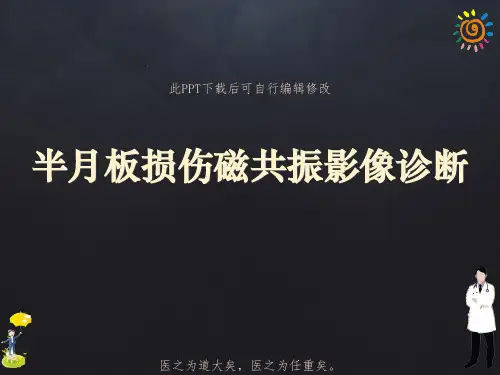 半月板损伤磁共振影像诊断PPT课件