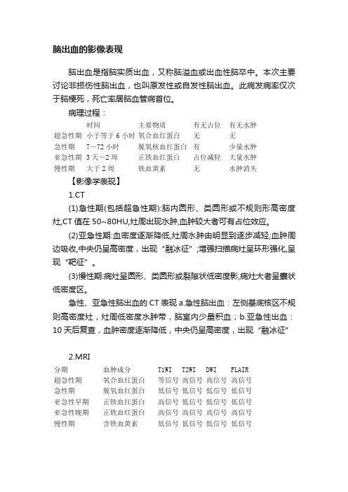 脑出血的影像表现