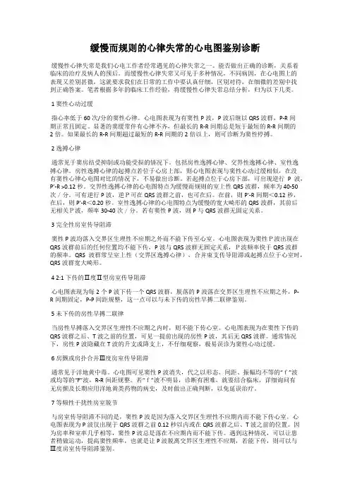 缓慢而规则的心律失常的心电图鉴别诊断