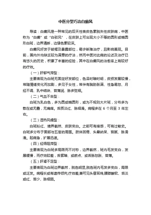 中医分型巧治白癜风