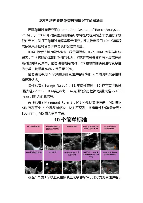 IOTA超声鉴别卵巢肿瘤良恶性简易法则