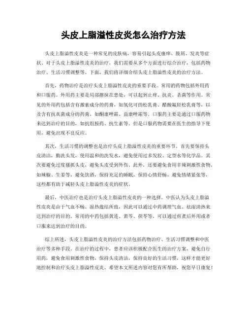 头皮上脂溢性皮炎怎么治疗方法