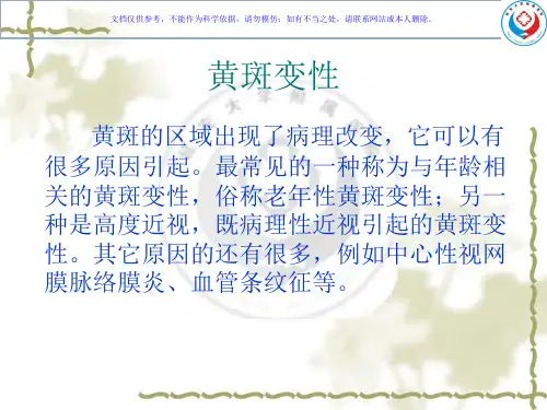 年龄相关性黄斑变性课件