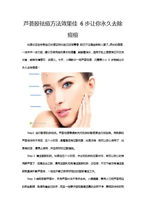 芦荟胶祛痘方法效果佳 6步让你永久去除痘痘