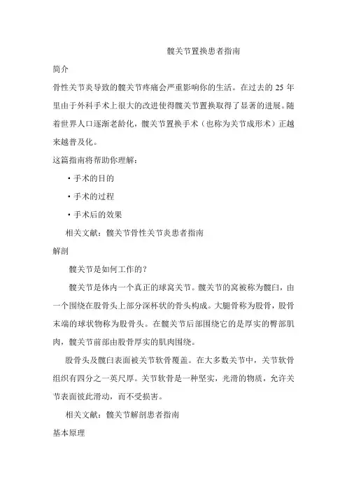 髋关节置换患者指南