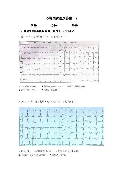心电图试题及答案-2