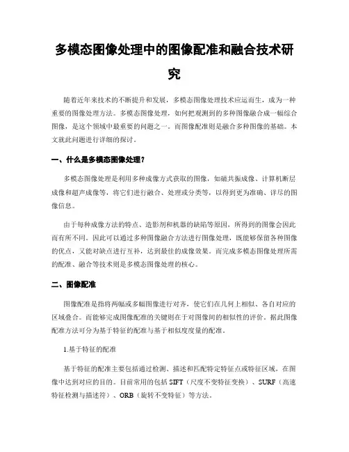 多模态图像处理中的图像配准和融合技术研究
