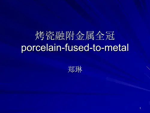 烤瓷融附金属全冠PPT课件