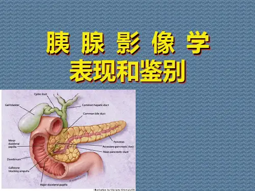 胰腺影像学表现和鉴别