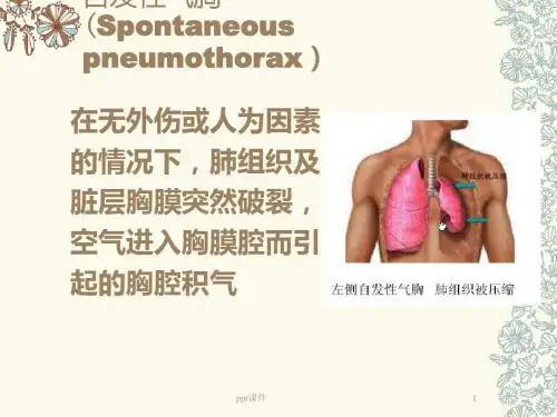 张力性气胸  ppt课件
