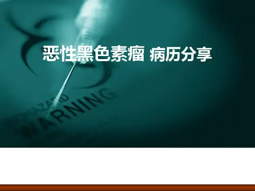 黑色素瘤ppt课件