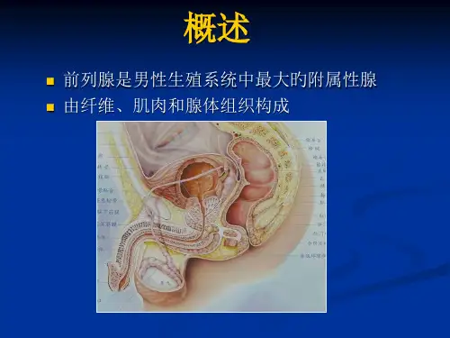 磁共振前列腺癌诊疗标准