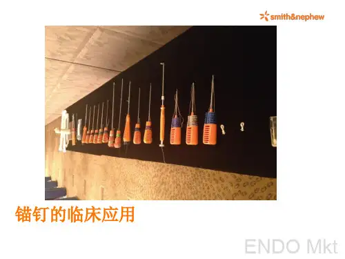 锚钉在创伤科的临床应用