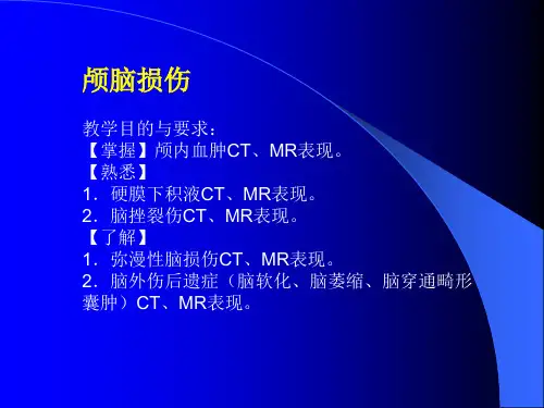 影像诊断见习课件 颅脑损伤