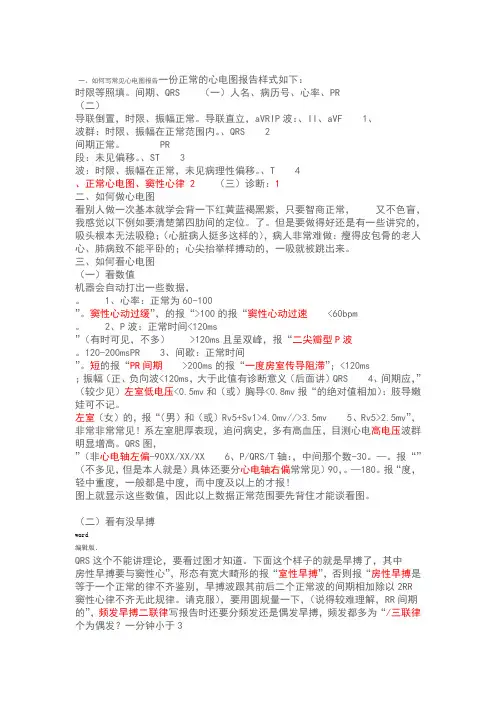 教你如何看懂心电图