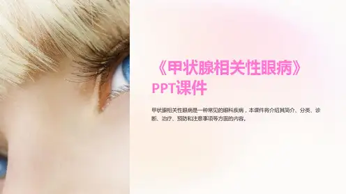 《甲状腺相关性眼病》课件