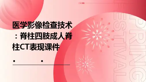 医学影像检查技术：脊柱影像脊柱四肢成人脊柱CT表现课件