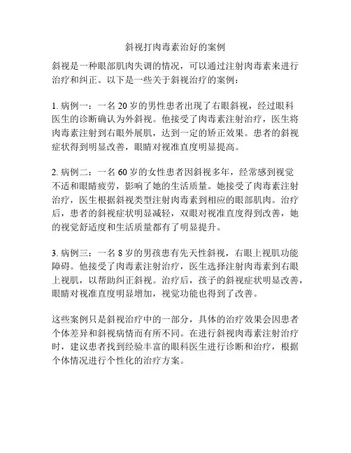 斜视打肉毒素治好的案例