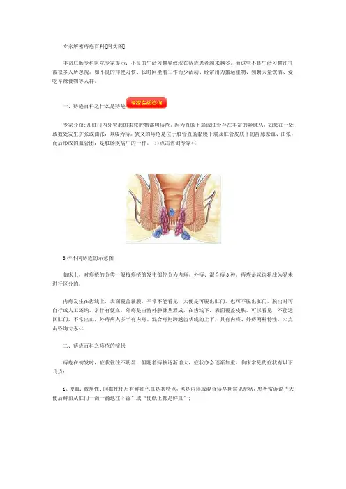 专家解密痔疮百科[附实图]