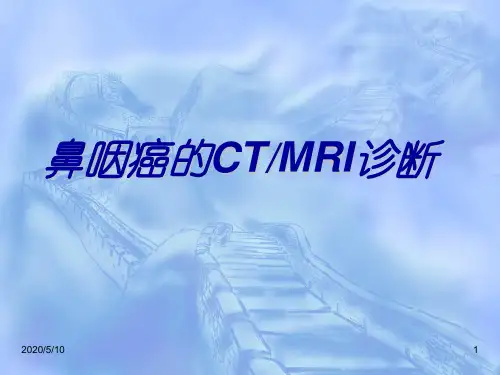 鼻咽癌CT与MRI