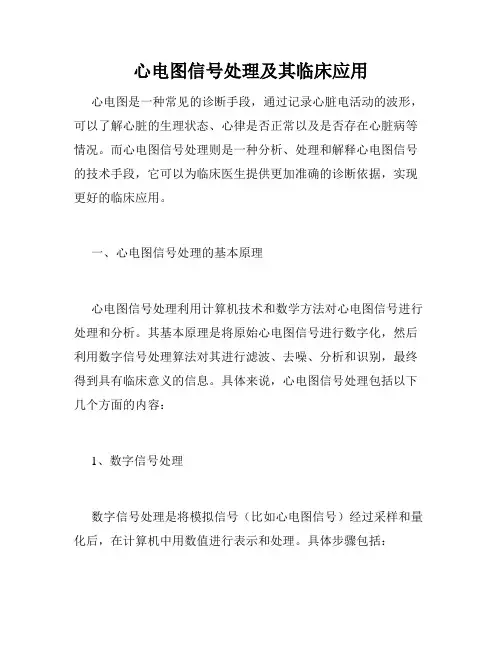 心电图信号处理及其临床应用