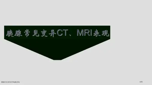 胰腺常见变异CT和MRI表现