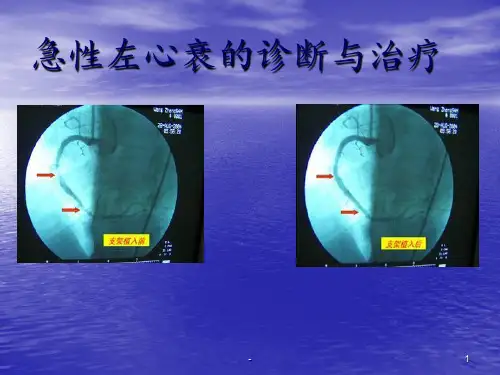 急性左心衰_图文PPT课件