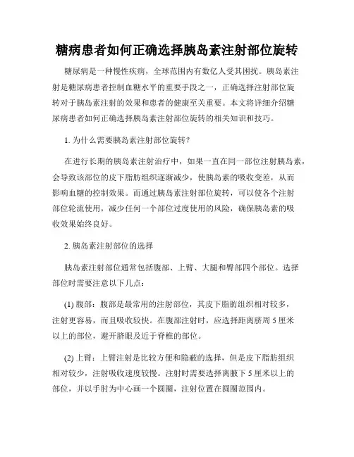 糖病患者如何正确选择胰岛素注射部位旋转