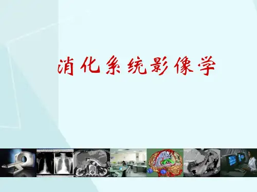医学影像诊断图文详解完整版消化系统影像诊断