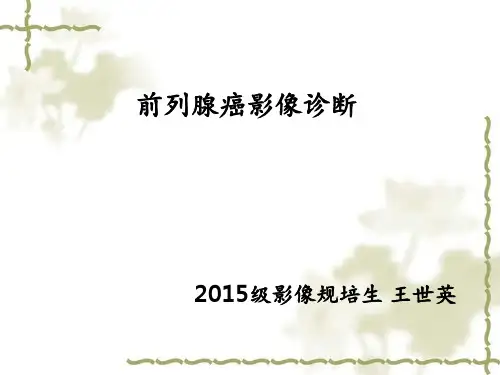 前列腺癌影像诊断【影像科】 ppt课件