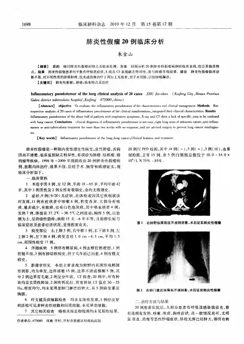 肺炎性假瘤20例临床分析