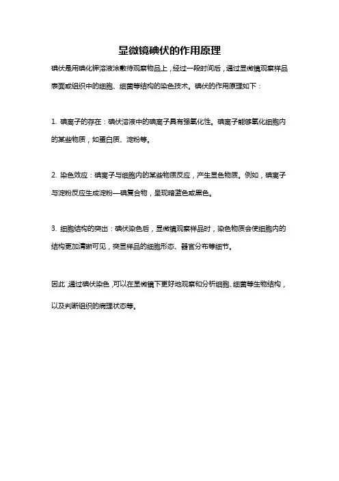 显微镜碘伏的作用原理