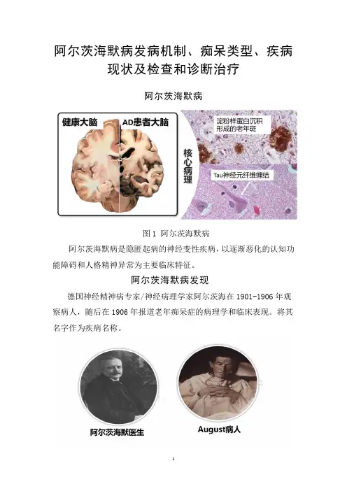 阿尔茨海默病发病机制、痴呆类型、疾病现状及检查和诊断治疗