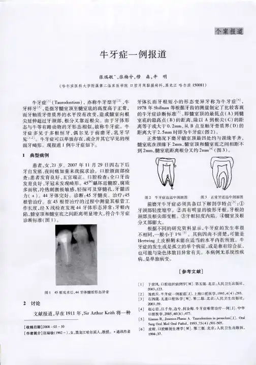 牛牙症一例报道