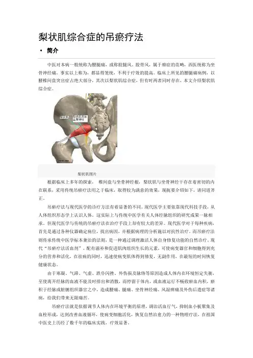 梨状肌综合症的吊瘀疗法