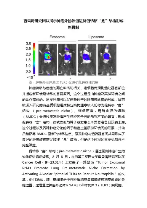 曹雪涛研究团队揭示肿瘤外泌体促进肺促转移“龛”结构形成新机制