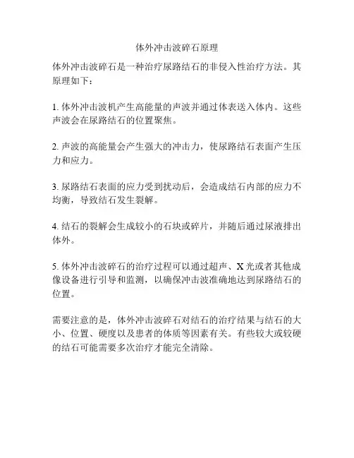体外冲击波碎石原理