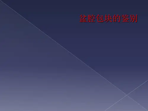 盆腔包块的鉴别