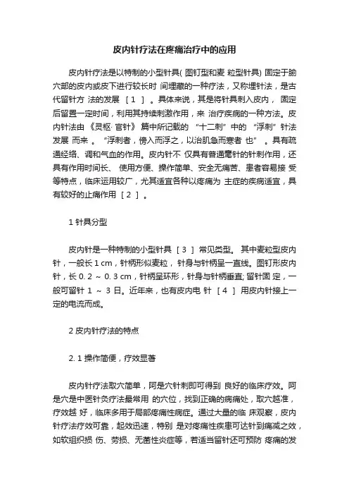 皮内针疗法在疼痛治疗中的应用