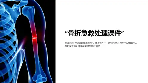 “骨折急救处理课件”
