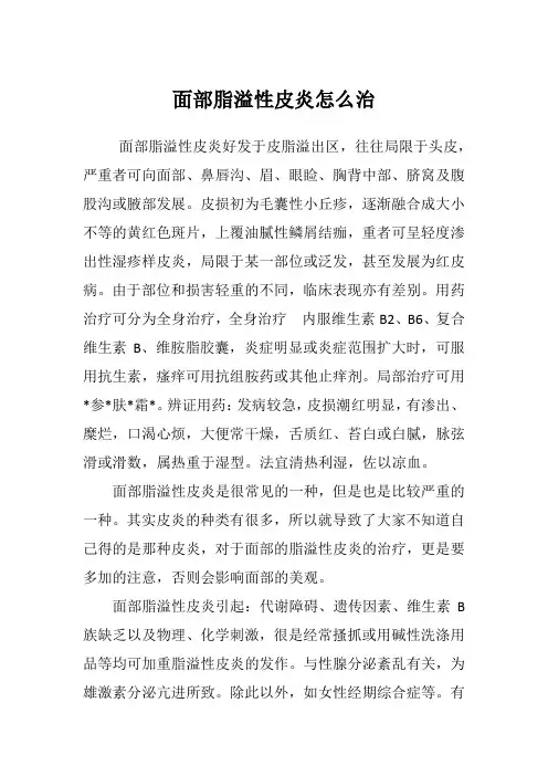 面部脂溢性皮炎怎么治