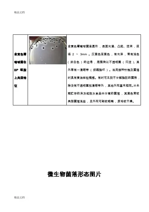 最新微生物菌落特征形态等总结大全(表格带图片)资料