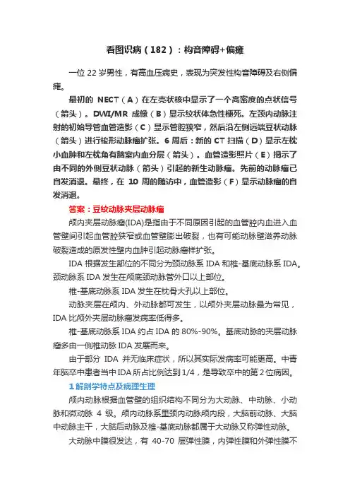看图识病（182）：构音障碍+偏瘫