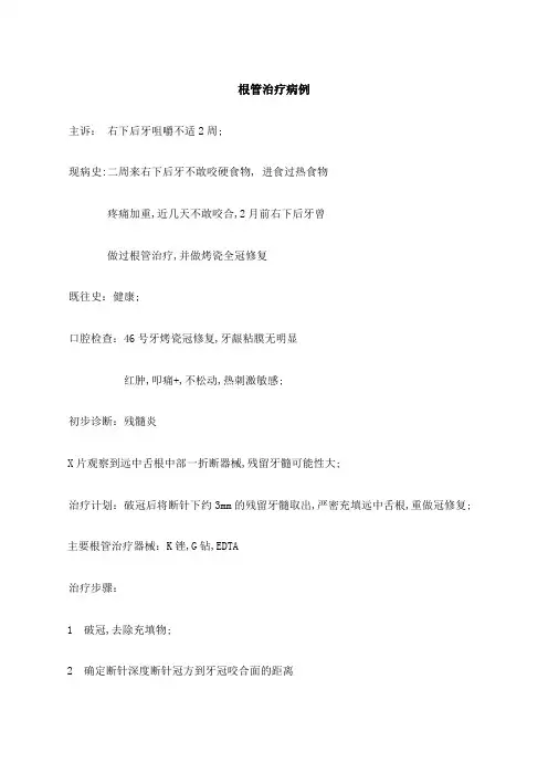 根管治疗病例