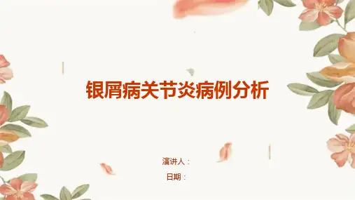银屑病关节炎病例分析